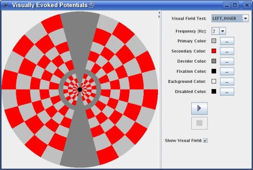 Visually Evoked Potentials